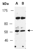 ENC1 Antibody Western (Abiocode)
