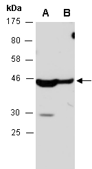 PDK4 Antibody Western (Abiocode)