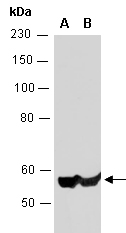 ZBTB8B Antibody Western (Abiocode)
