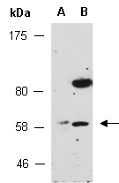 ZBTB8A Antibody Western (Abiocode)