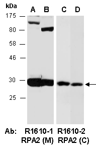 RPA2 Antibody Western (Abiocode)