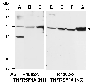 TNFRSF1A Antibody Western (Abiocode)