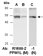 PPM1L Antibody Western (Abiocode)