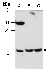CTF1 Antibody Western (Abiocode)