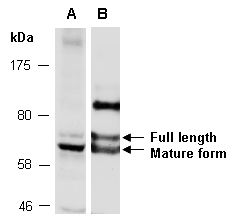 MMP2 Antibody Western (Abiocode)