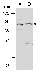 TNFRSF1B Antibody Western (Abiocode)
