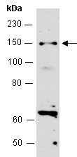 MSH3 Antibody Western (Abiocode)