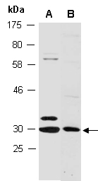 NKX2-6 Antibody Western (Abiocode)