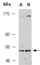 MEF2A Antibody Western (Abiocode)