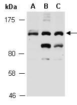 SMC3 Antibody Western (Abiocode)