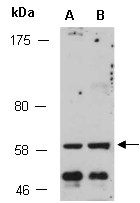 AKT1 Antibody Western (Abiocode)