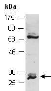 SSU72 Antibody Western (Abiocode)