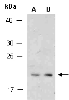 RCL Antibody Western (Abiocode)
