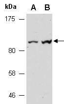 PGR Antibody Western (Abiocode)