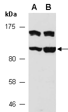 ASAP3 Antibody Western (Abiocode)