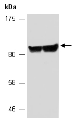 CYBB Antibody Western (Abiocode)