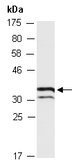 MKI67IP Antibody Western (Abiocode)