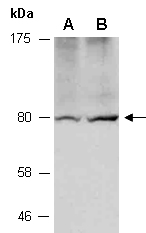 ZDHHC8 Antibody Western (Abiocode)