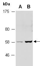 ZSCAN18 Antibody Western (Abiocode)