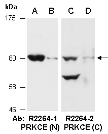 PRKCE Antibody Western (Abiocode)