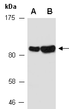 MMP9 Antibody Western (Abiocode)