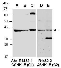 CSNK1E Antibody Western (Abiocode)