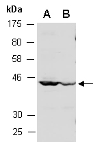 PPP1R1B Antibody Western (Abiocode)