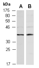 FOSL1 Antibody Western (Abiocode)