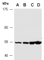 FSCN1 Antibody Western (Abiocode)