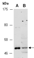 KYNU Antibody Western (Abiocode)