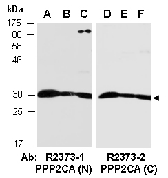 PPP2CA Antibody Western (Abiocode)