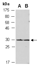 RNF5 Antibody Western (Abiocode)