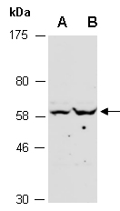 PKMYT1 Antibody Western (Abiocode)