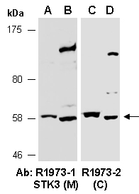 STK3 Antibody Wester (Abiocode)