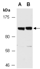 ENNP1 Antibody Western (Abiocode)