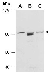 FOXO1 Antibody Western (Abiocode)