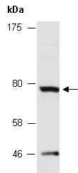 PPP2R1B Antibody Western (Abiocode)