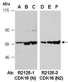 CDK16 Antibody Western (Abiocode)