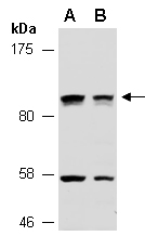 UNC5C Antibody Western (Abiocode)