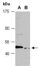 STK38L Antibody Western (Abiocode)