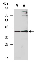 ZDHHC4 Antibody Western (Abiocode)