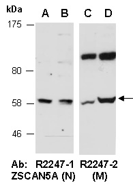 ZSCAN5A Antibody Western (Abiocode)