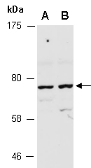 RNF6 Antibody Western (Abiocode)