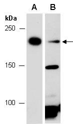BAZ2B Antibody Western (Abiocode)
