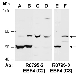 EBF4 Antibody Western (Abiocode)