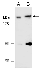 MLLT4 Antibody Western (Abiocode)