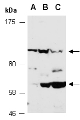 FAM65B Antibody Western (Abiocode)