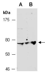 MAP3K2 Antibody Western (Abiocode)