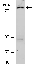 CUL7 Antibody Western (Abiocode)