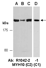 MYH10 Antibody Western (Abiocode)